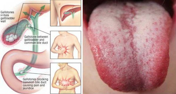 You-Need-To-Flush-Toxins-Out-Of-Your-Body-If-You-See-These-9-Warning-Signs