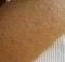 7 Signs Of Gluten Intolerance, Everyone Ignores!
