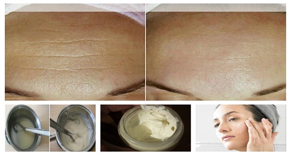 Anti-Aging Homemade Cream to Get Rid of Lines and Wrinkles on Your Face in Less Than Two Weeks