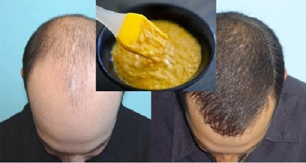 Extremely Effective Homemade Mask for Hair Growth!