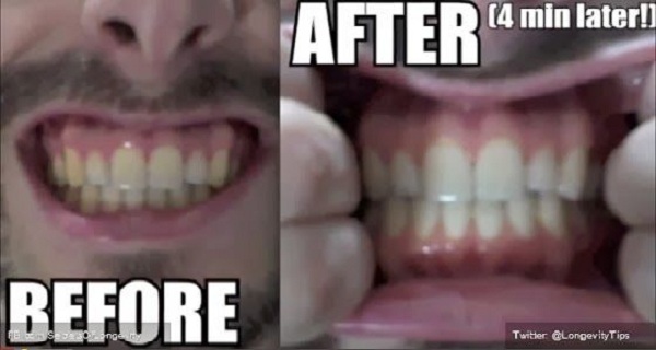 Use This Herb To Naturally Whiten Teeth( Video)