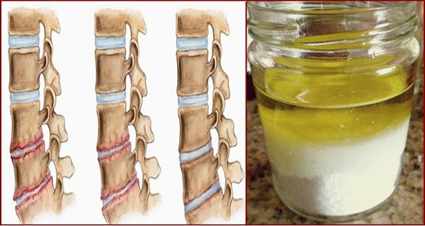 diy-salt-and-oil-healing-mixture-against-osteochondrosis