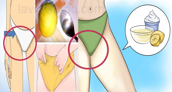 How to Lighten Dark Skin in Pubic Area and Between Legs (1 Ingredient Recipes)