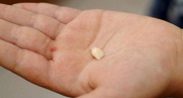 You Knocked-Out a Tooth Here's What You Should Do IMMEDIATELY to Save It!