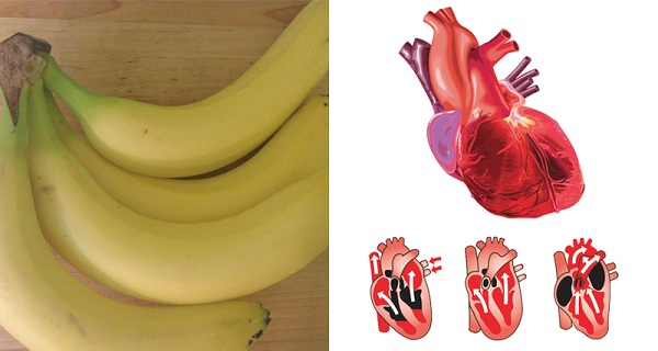 5 Health Problems You Can Heal with Bananas Instead of Medication