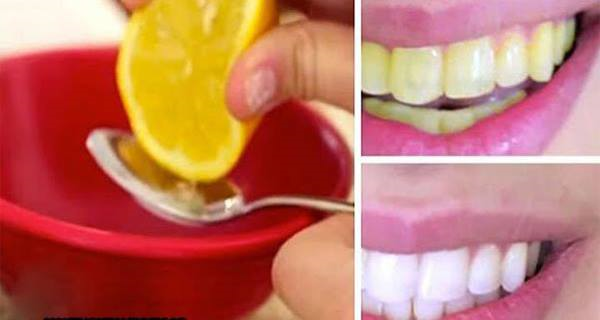 WATCH YOUR TEETH GET WHITE IN JUST 2 MIN WITH THIS HOME REMEDY