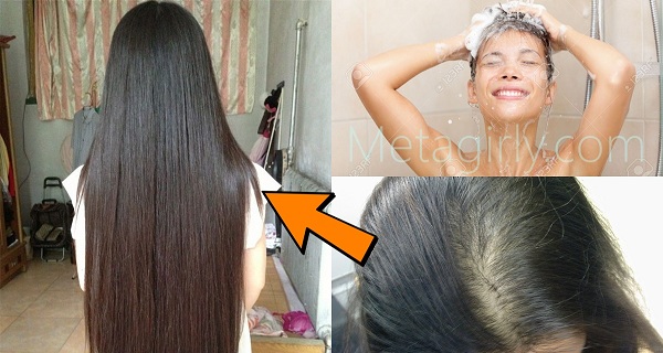 6 Things You Should Know To Stop Hair Loss FOREVER, instantly!