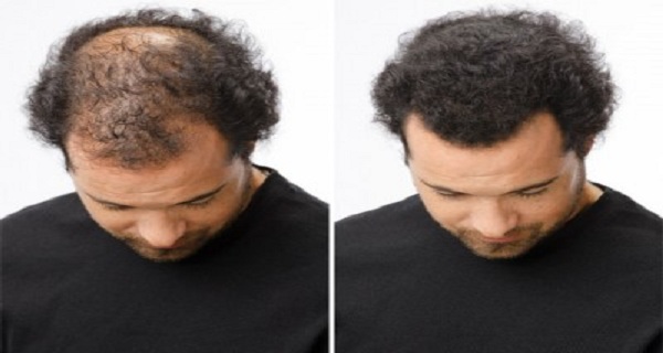 THE MAGIC HOMEMADE RECIPE FOR FASTEST HAIR GROWTH! 3 INGREDIENTS ONLY