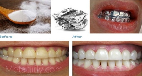 Wrap Your Teeth with Aluminum Foil and See the Magic!
