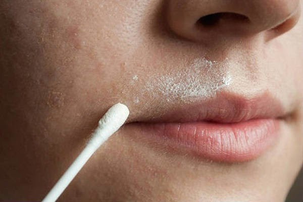 bello-facial