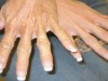 Amazing Recipe To Stop Your Hands From Revealing Your Age!