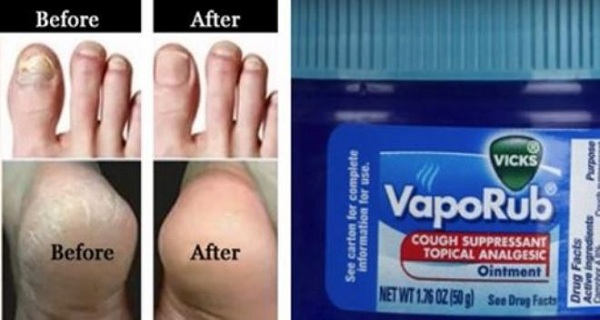 Apparently-Ive-Been-Using-Vicks-VapoRub-Wrong-This-Whole-Time.-Here-Are-7-Surprising-Uses