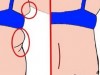 Do You Have Excess Fat That “Statues” All-Round Bra? There Is A Solution How To Remove It (VIDEO)