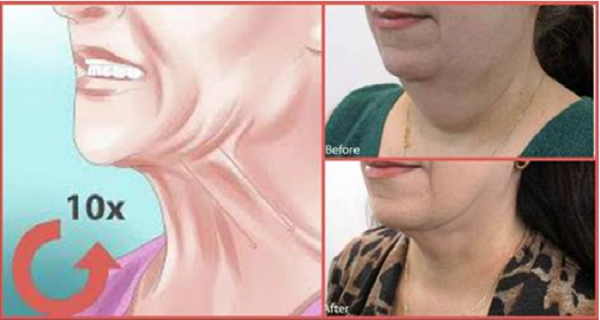 Get Rid Of Double Chin Forever With This Simple Trick – All You Need Is One Ingredient!