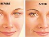 Here’s How To Tighten Loose Skin On The Eyelids In Just 4 Steps !