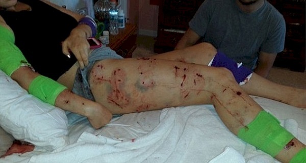 She Went For A Jog, And Is Now Fighting For Her Life. The Reason Why Will Shock You