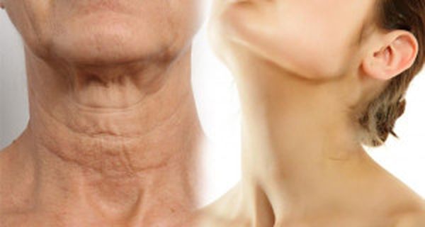 Simple Ways On How To Make Your Neck Look Younger