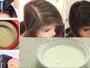 Thin And Bald Hair Magic! Grow Your Hair Fast With Only 2 Ingredients