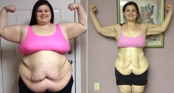 You Will Be Shocked How This 17-YEAR-OLD GIRL Lost Half Her Weight in Just 1 Year!