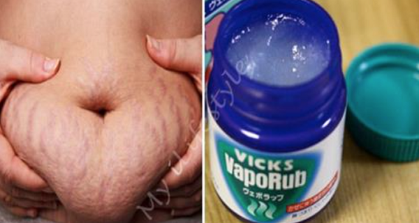 How-To-Use-Vicks-VapoRub-To-Get-Rid-Of-Accumulated-Belly-Fat-And-Cellulite-Eliminate-Stretch-Marks-And-Have-Firmer-Skin