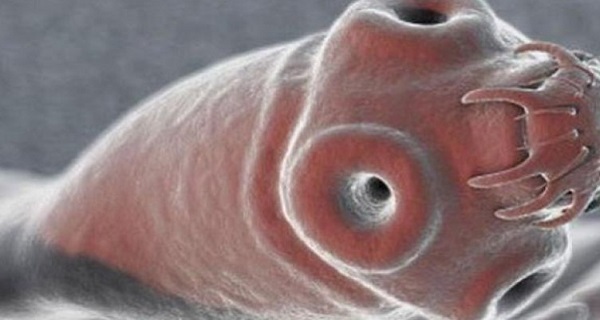 IMPORTANT CNN Do Not Eat These Foods As They Can Make Worms Born In Your Body