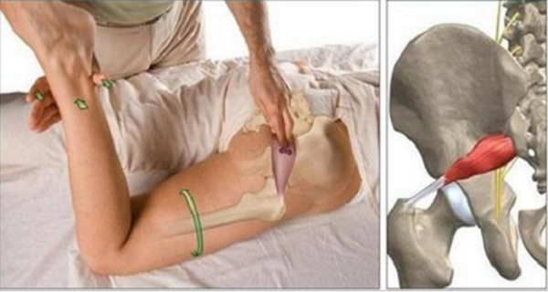 After Reading This You Will Forget About the Sciatica Pain Forever (VIDEO)