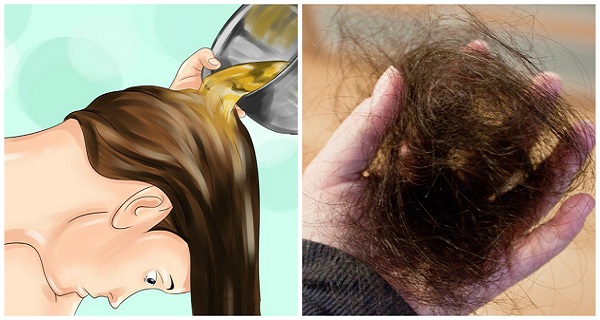 How-to-finally-stop-the-hair-loss-Grow-back-your-hair-naturally-faster-and-stronger..