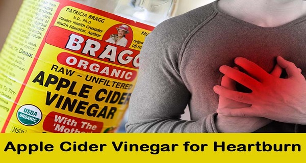 apple-cider-vinegar-for-heartburn