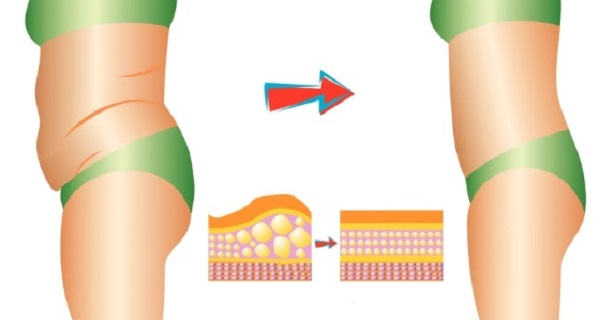 effective-home-remedies-for-fat-loss-without-going-to-the-gym