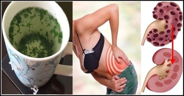 Eliminate Kidney Stones Painlessly With This Amazing Homemade Remedy