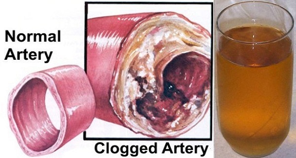 Just One Glass Of This Drink Will Cleanse Your Blood Vessels Miraculously