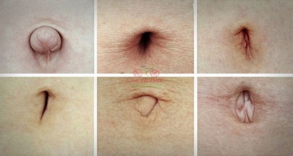 Take-a-Look-at-Your-Navel-If-You-Have-One-of-These-Shapes-You-Might-Want-to-Read-THIS