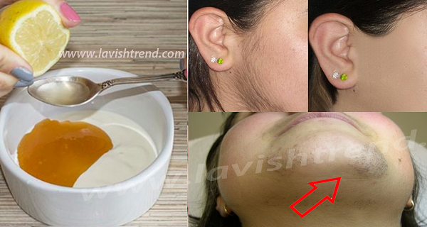 With This Natural Recipe Your Facial Hair Will Disappear Forever